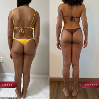 Frame 1707478636 (1)